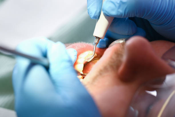 Best Urgent Dental Care for Toothache in San Augustine, TX