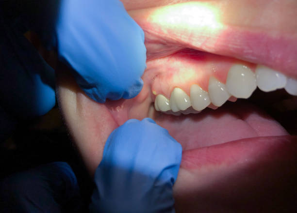 Best Urgent Dental Care for Toothache in San Augustine, TX